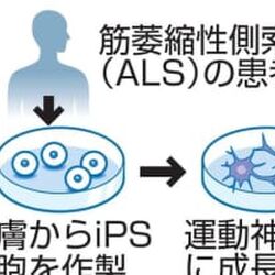 難病 筋萎縮性側索硬化症 Als の治療に有効な既存薬をips細胞を使って探し出し 中略 進行を止める薬は 世界初 のニュースに歓喜の声多数 Togetter